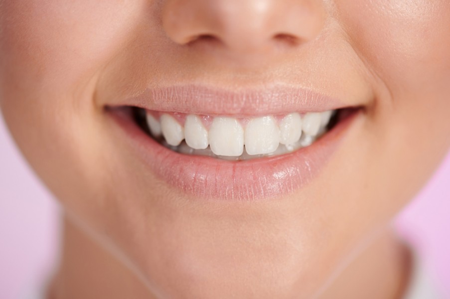Comment obtenir un sourire parfait avec une dent parfaite ?