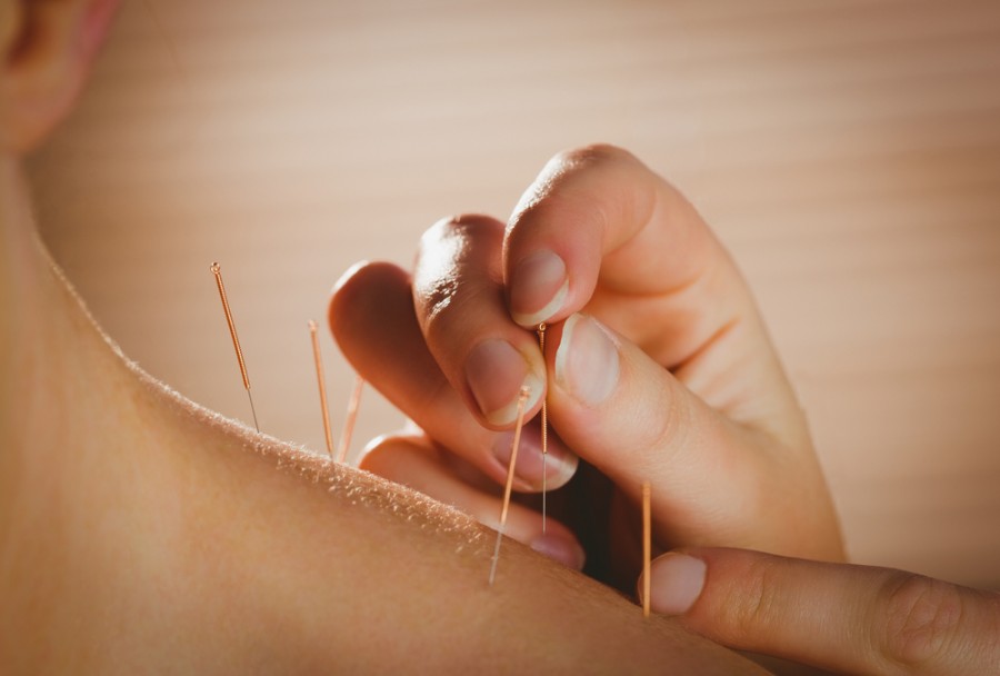 Quand Ressent-on les effets d'une séance d'acupuncture ?