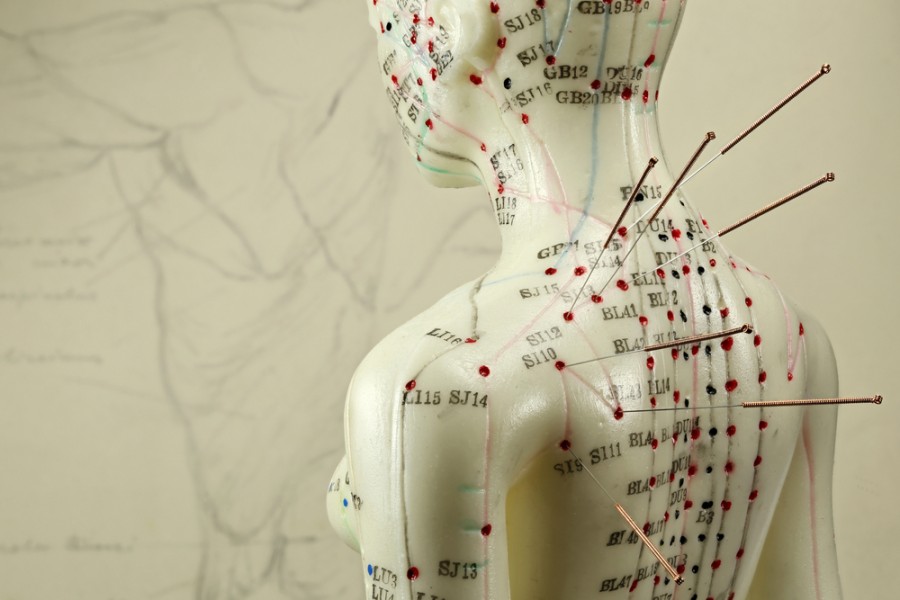 Quelles preuves scientifiques soutiennent les délais d'effet de l'acupuncture ?