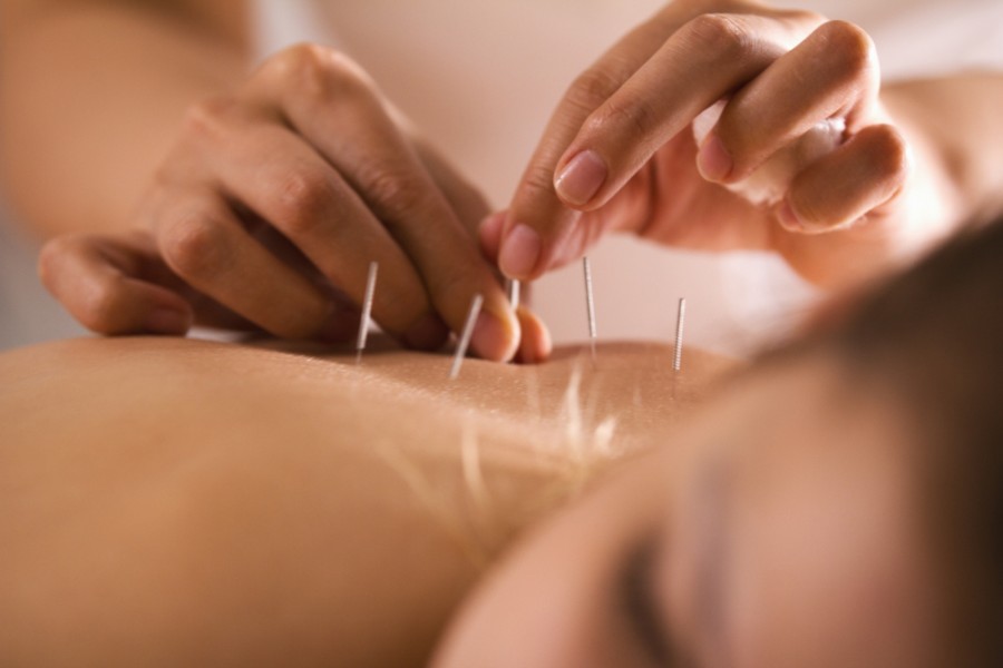 Au bout de combien de temps ressent-on l'effet de l'acupuncture ?