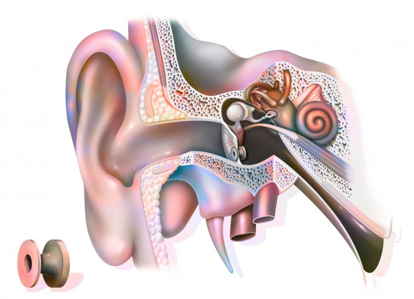 Comment choisir le meilleur drain d'oreille pour soulager vos problèmes auditifs ?