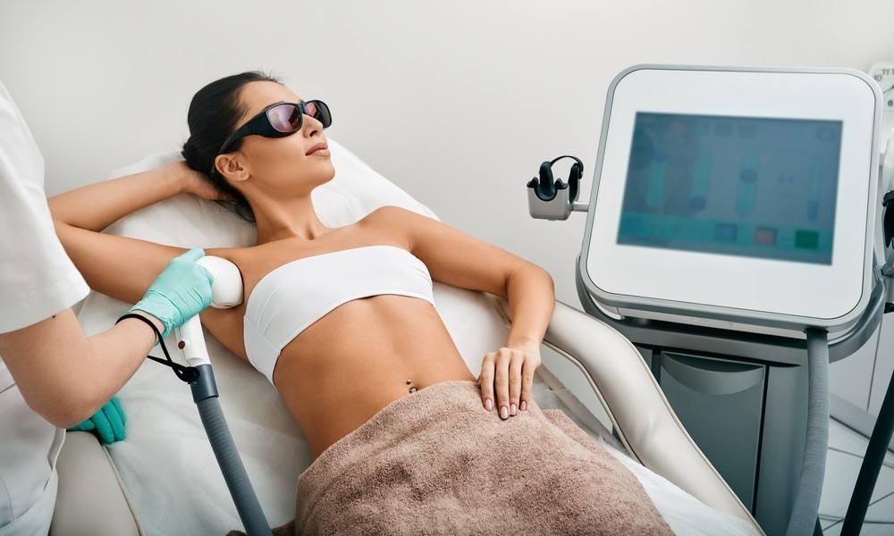 Delai entre 2 seances epilation laser : le rythme à respecter
