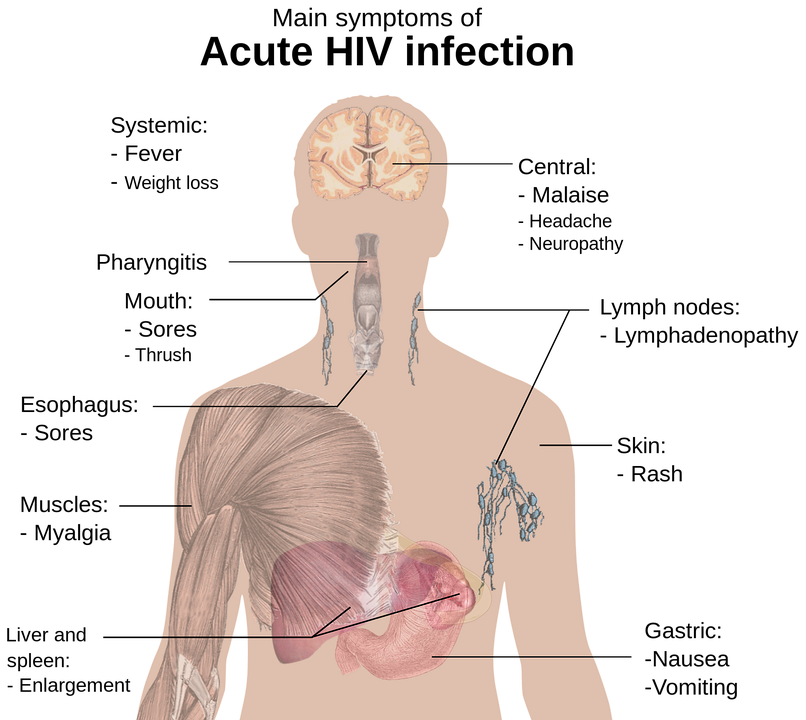 Anneau gastrique virtuel : est-ce que ça fonctionne vraiment ?